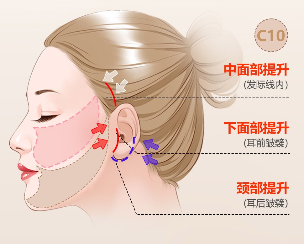 1741601249181335.jpg 微信图片_20250310180529.jpg