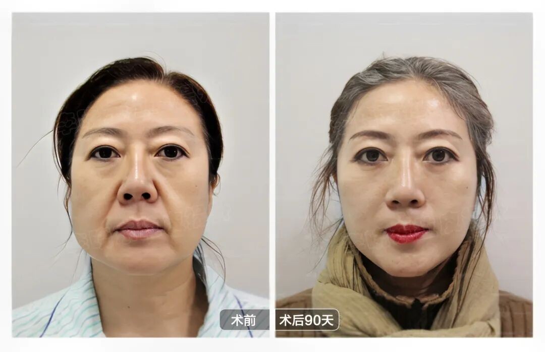 1773138796248135.jpg 微信图片_2026-03-10_183122_327.jpg