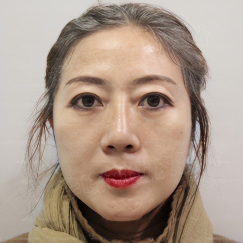 1773138813876208.jpg 微信图片_2026-03-10_183128_565.jpg